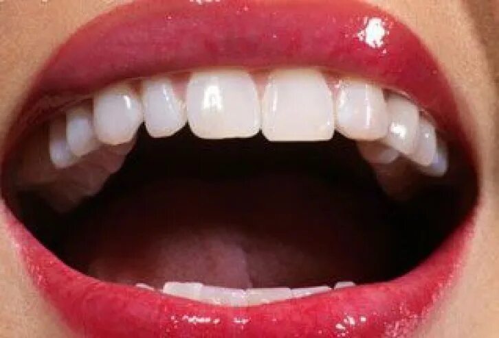 Зубы внутри рта. Идеальные зубы открытый рот. Здоровые зубы и полость рта. Открытый рот внутри рта.