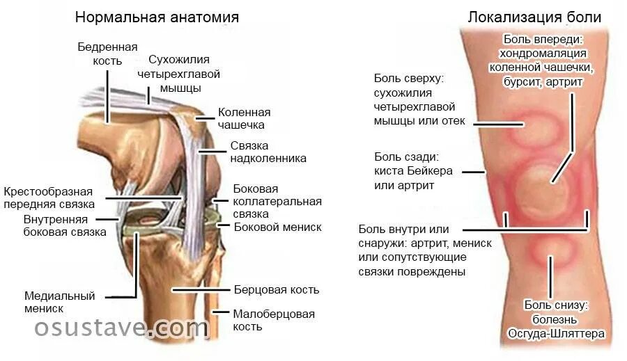 Со внутренней стороны. Болит над коленной чашечкой спереди. Болит с внешней стороны колено сбоку болит. Боль в колене спереди под чашечкой с внешней стороны. Боли при згибании и разгибание в колене.