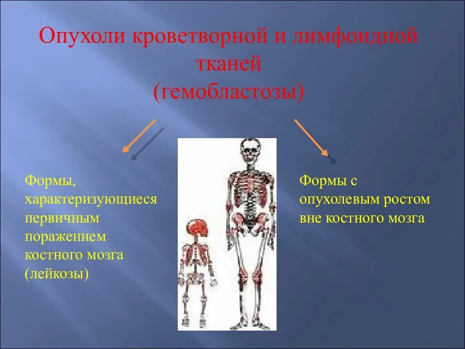 Селезёнка органы кроветворения и иммунной системы. Новообразование лимфоидной кроветворной ткани. Лимфоидной кроветворной и родственных им тканей. Злокачественная опухоль эпителиальной ткани. Лимфоидной кроветворной и родственных им тканей.