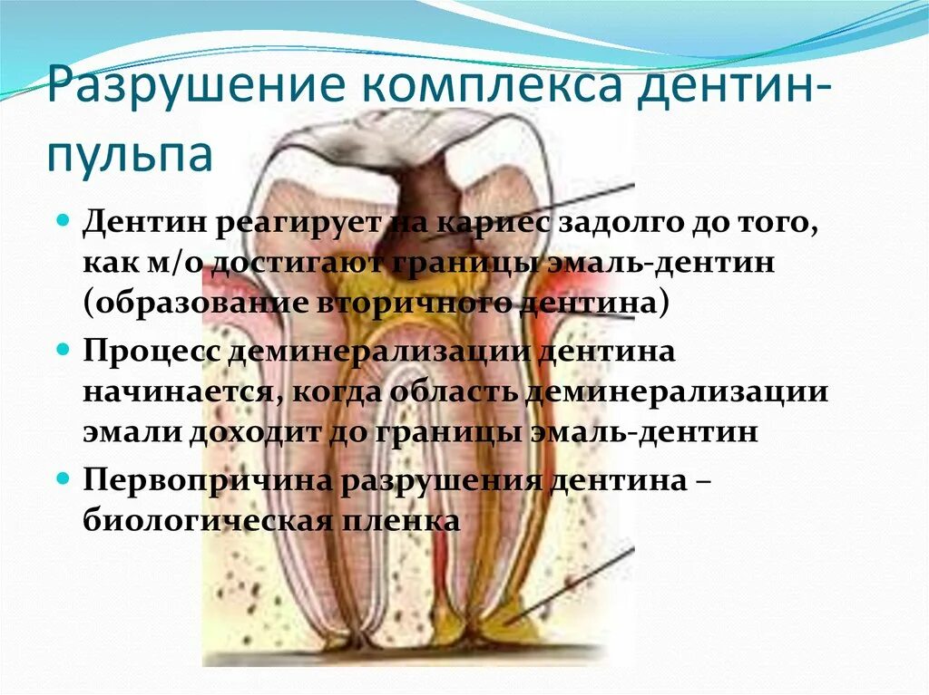 Дентин формируется. Первичный вторичный и третичный дентин. вторичный и третичный дентин. образование третичного дентина.