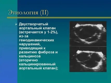 Двустворчатый клапан форум