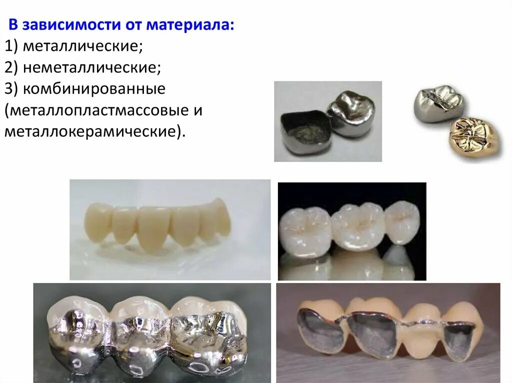 Коронка цельнолитая КХС. Стальная штампованная коронка. Цельнолитая коронка (КХС С напылением). Коронка цельнолитая, зуб цельнолитой.