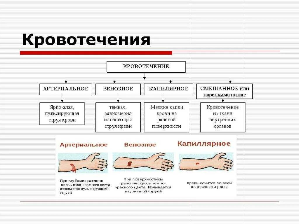 Кровотечения бывают следующих видов ответ. Таблица виды кровотечений характеристика кровотечений первая помощь. Виды наружных кровотечений: венозное, (……..), артериальное. Кровотечение схема первая помощь-. Артериальное и венозное кровотечение первая помощь.