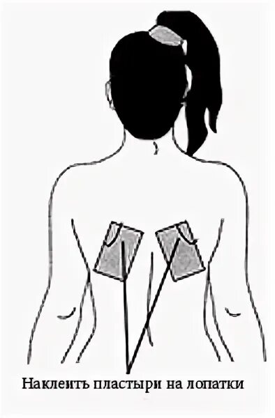 Правильно приклеить перцовый пластырь. Перцовый пластырь при кашле. Перцовый пластырь при боли под лопаткой. Перцовый пластырь на спину при кашле. Перцовый пластырь на грудь.