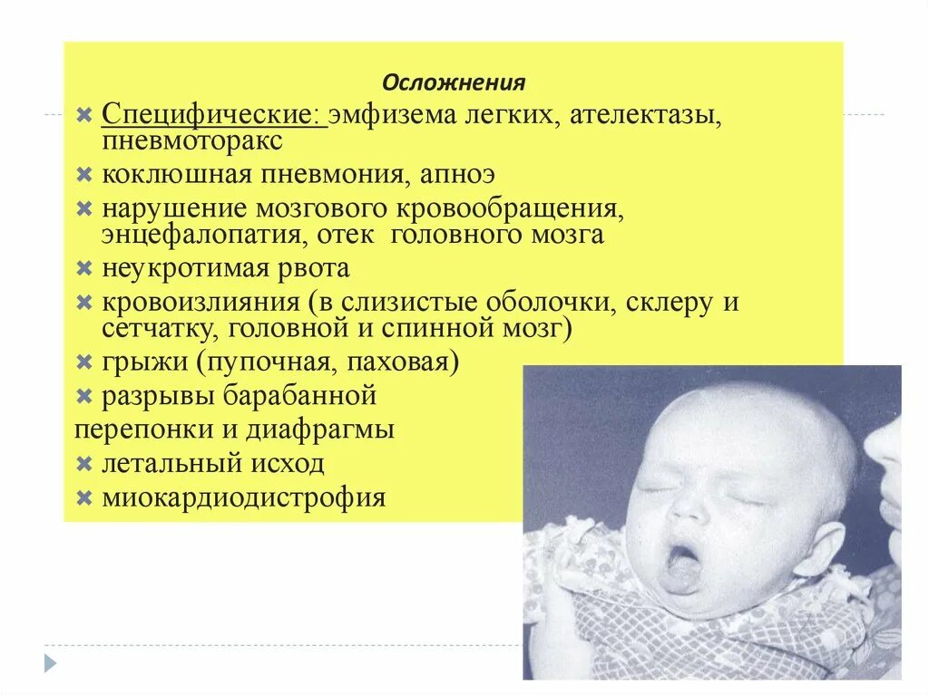 Отек мозга у новорожденных. Последствия спинномозговой грыжи у младенцев. Пневмония при коклюше у детей. Отек головного мозга у детей.