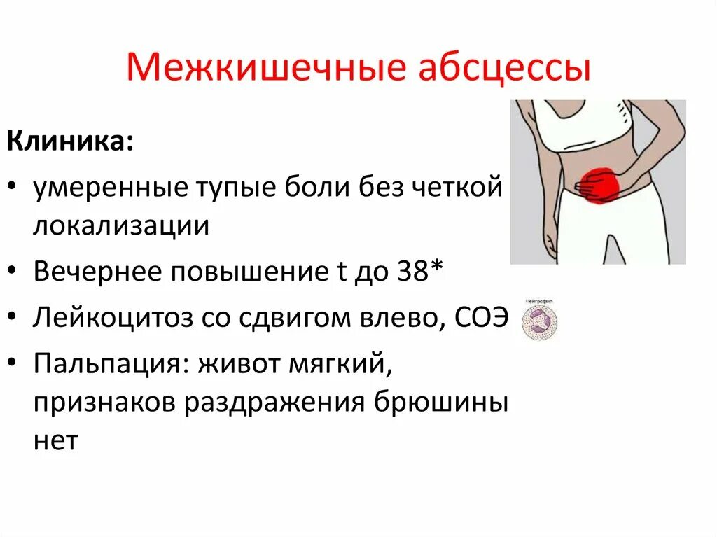 Симптом брюшины