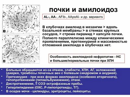 Амилоидоз препарат
