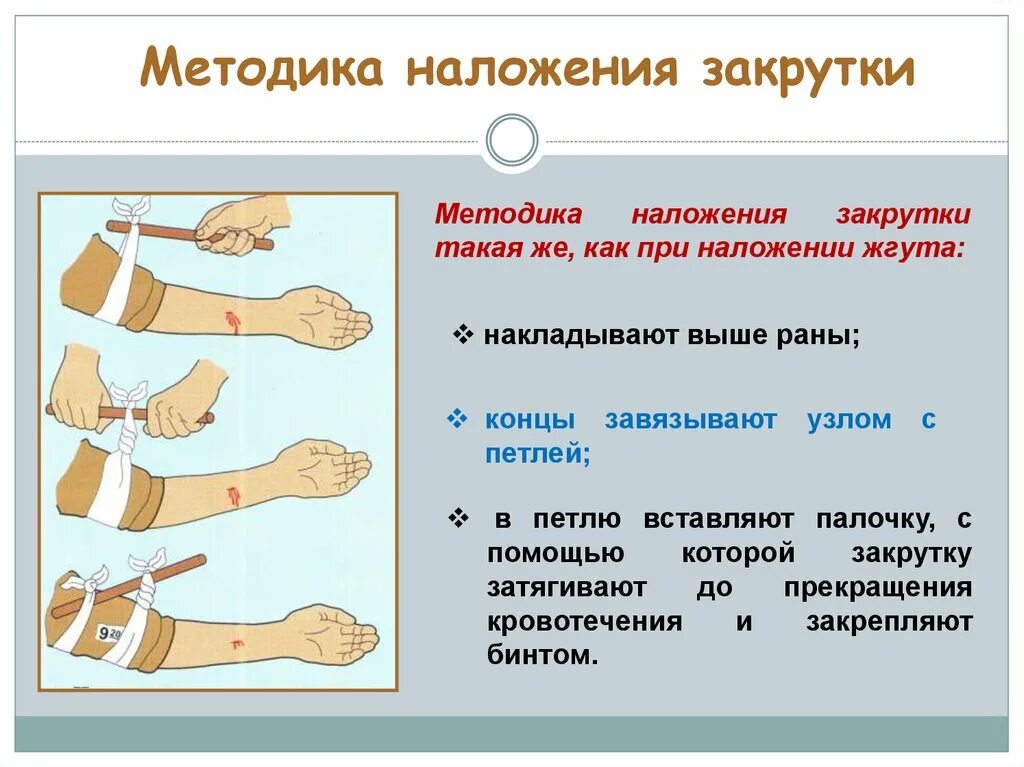 Жгут можно накладывать при кровотечении. Методы наложения жгута при кровотечениях. Методика наложения жгута закрутки при артериальном кровотечении. Алгоритм последовательность действий при наложении жгута. Наложение жгута закрутки при артериальном кровотечении.