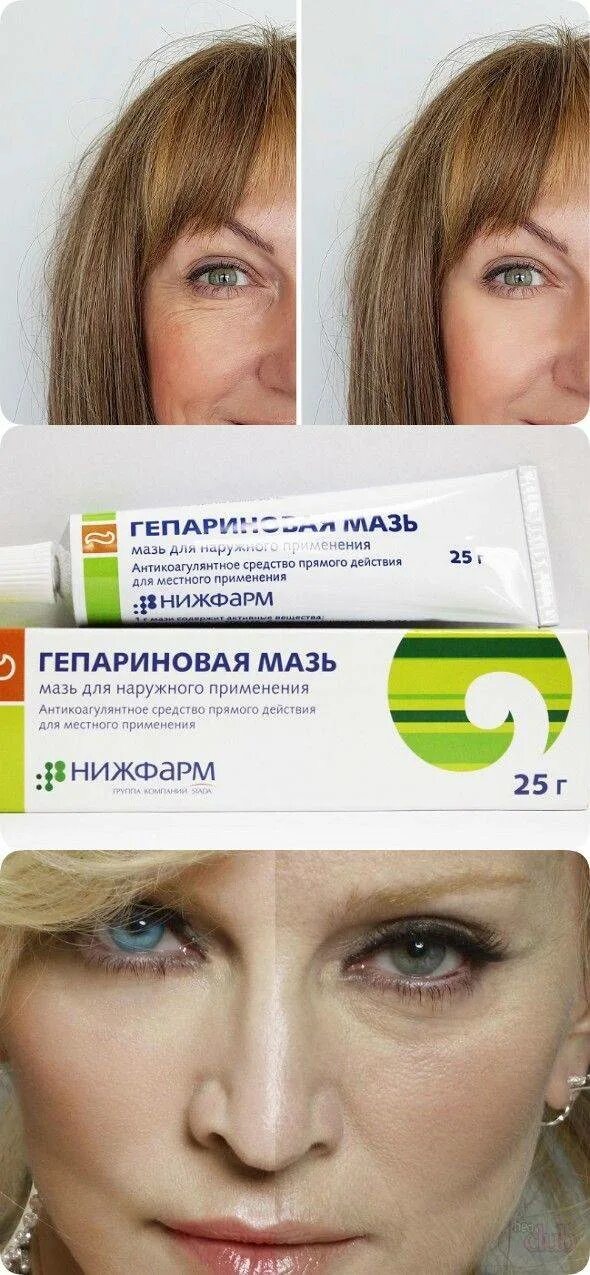 Мази против морщин из аптеки за копейки. Мазь от морщин вокруг глаз отзывы. Мазь от морщин вокруг глаз отзывы. Крем 35+ для век. Мазь от морщин вокруг глаз.