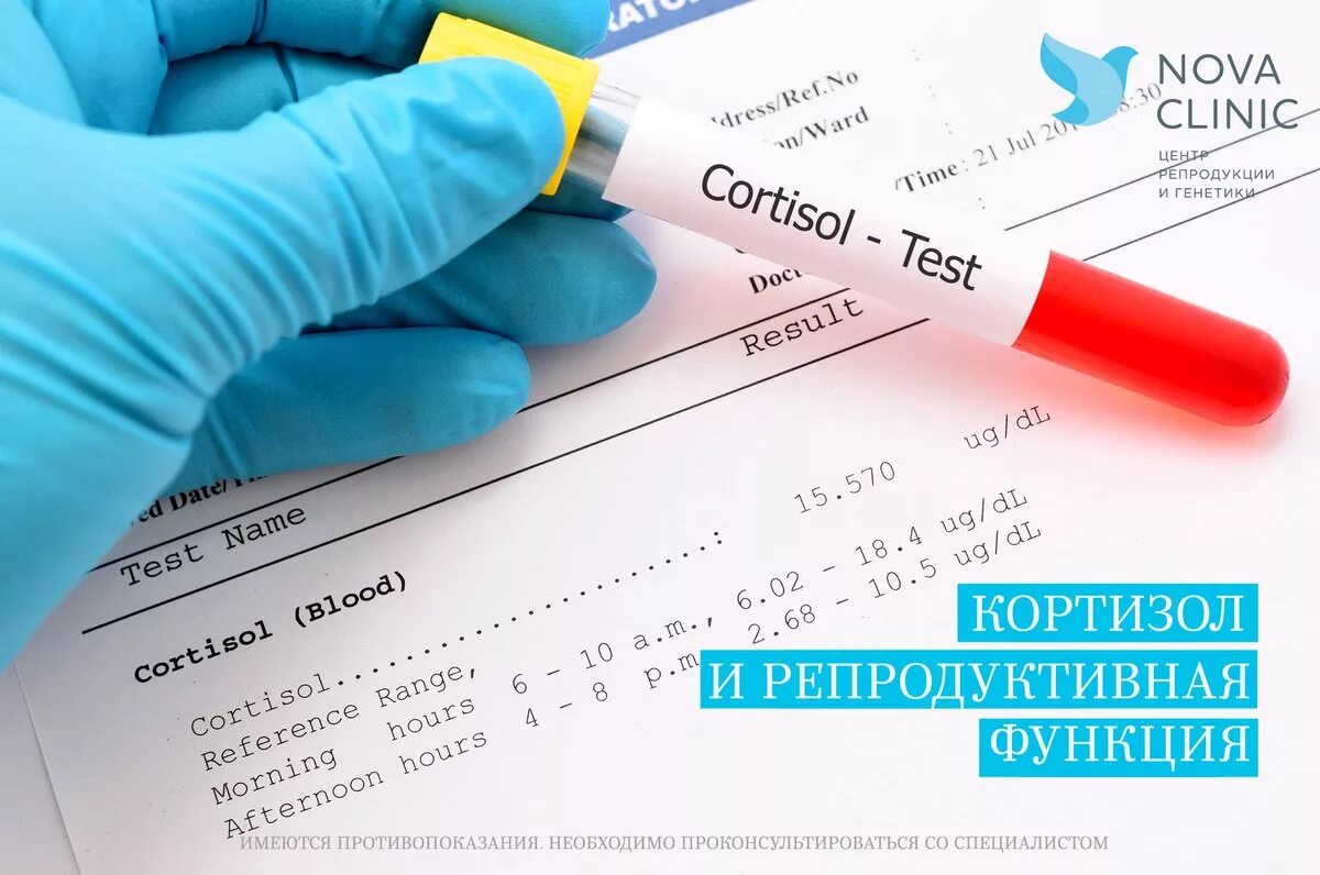 Анализ крови на стресс. Исследование на кортизол. Кортизол анализ. Кортизол анализ крови. Исследование кортизола в крови.