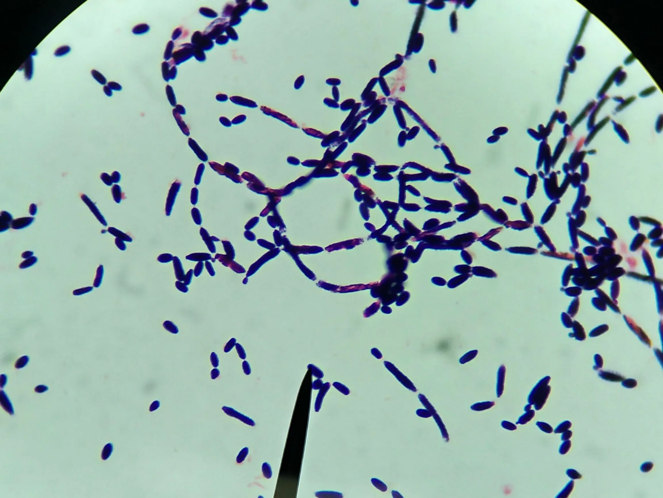 Грамотрицательные микрококки. Стафилококк ауреус микроскопия. Генцианвиолет и грамположительные. Методу. Streptococcus pyogenes микроскопия.