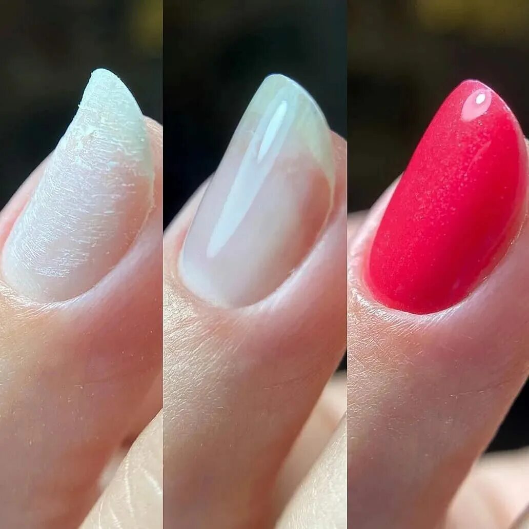 Клюющая форма ногтей. Трамплинообразный ноготь. Наращивание трамплинообразных ногтей. Наращивание на вверх растущие ногти. Ногти наверх.