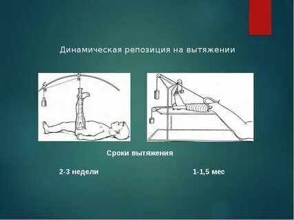 Репозиция это