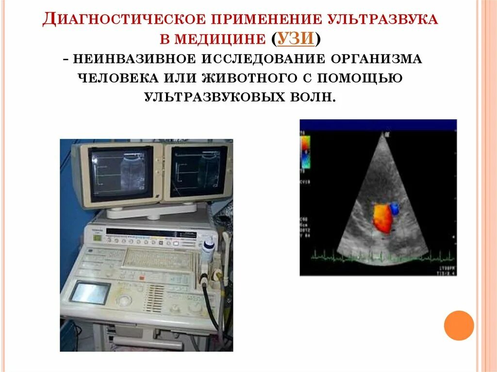 Ультразвук как проходит. Источники ультразвука в медицине. ультразвук в медицине узи. ультразвуковые исследования в медицине. ультразвуковые колебания в узи.