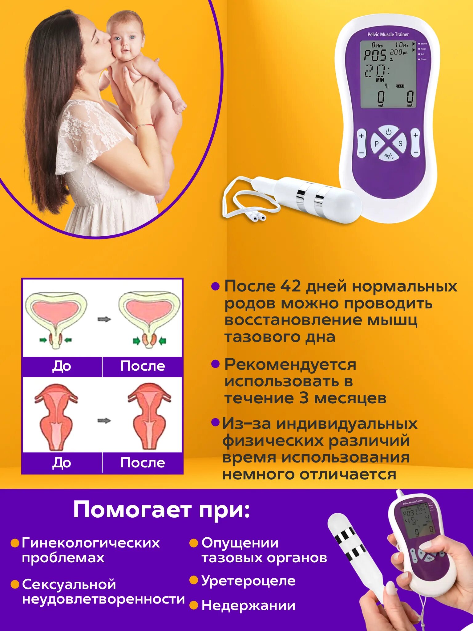 тренажёр для мышц тазового дна кегель. тренажер пневмо вагитон. тренажер для интимных мышц. тренажёр для интимных мышц вагитон. пневматический тренажер кегеля xft-0010.