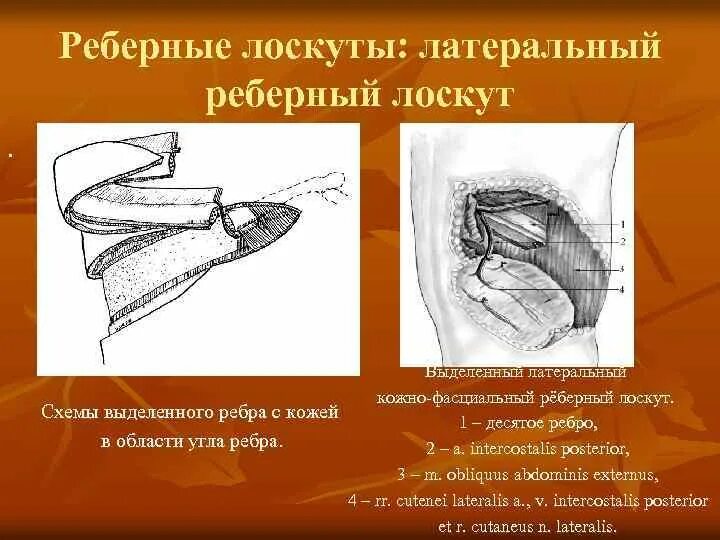 Перламутровые лоскуты