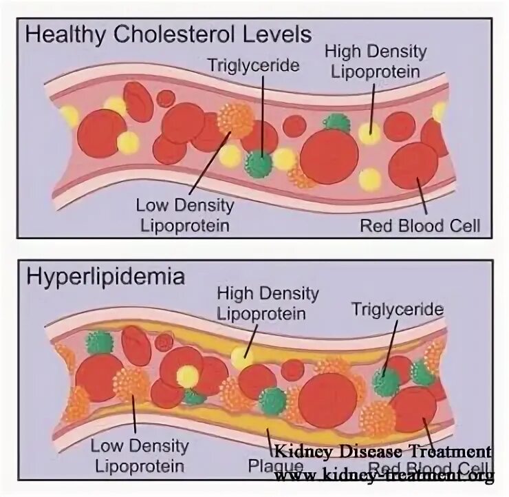 Cholesterol levels