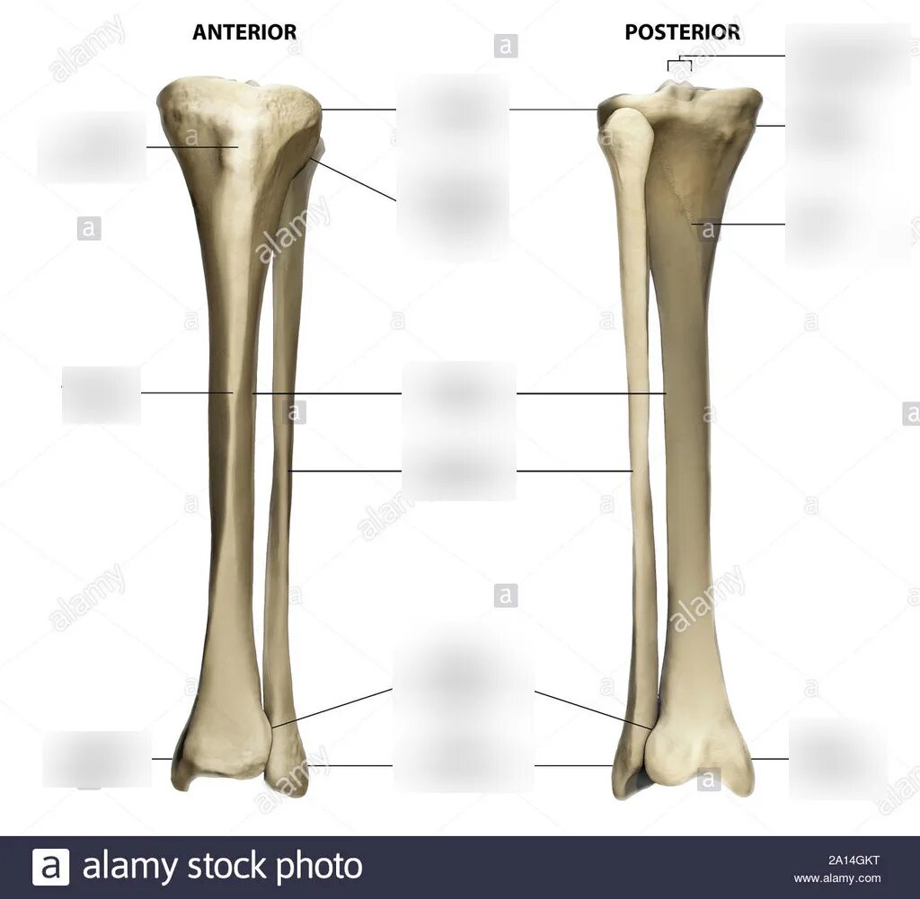 Curved tibia fibula. Антериор и постериор. lateral malleolus кость. tibia анатомия. нога кости lateral.