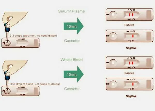 Тест на крови отрицательный. Экспресс тест ВИЧ 1/2 положительный результат. Экспресс тест на ВИЧ интерпретация результатов. Экспресс тест на СПИД отрицательный. Проведение экспресс теста.