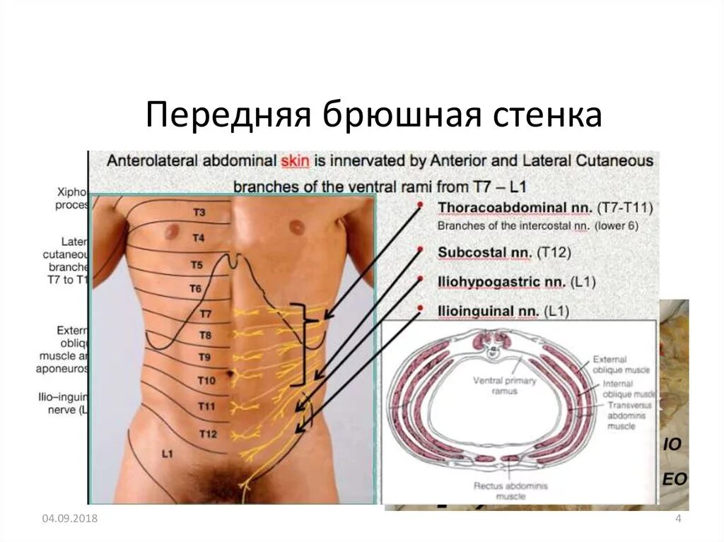 Функциональная анатомия передней брюшной стенки. Послойная анатомия передней брюшной стенки. Иннервация переднебоковой брюшной стенки. Иннтерваяи передней брюшной стенки. Толстая брюшная стенка