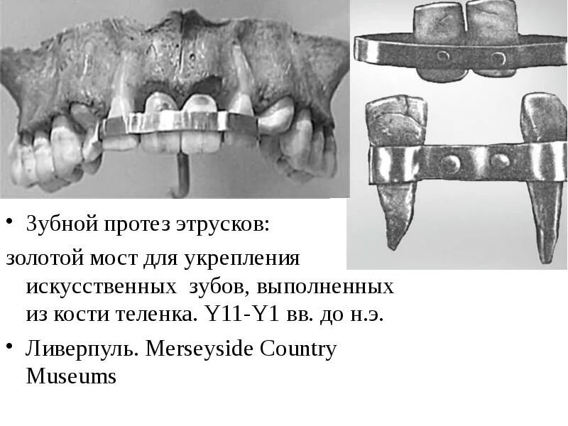 Зубы в древнем риме