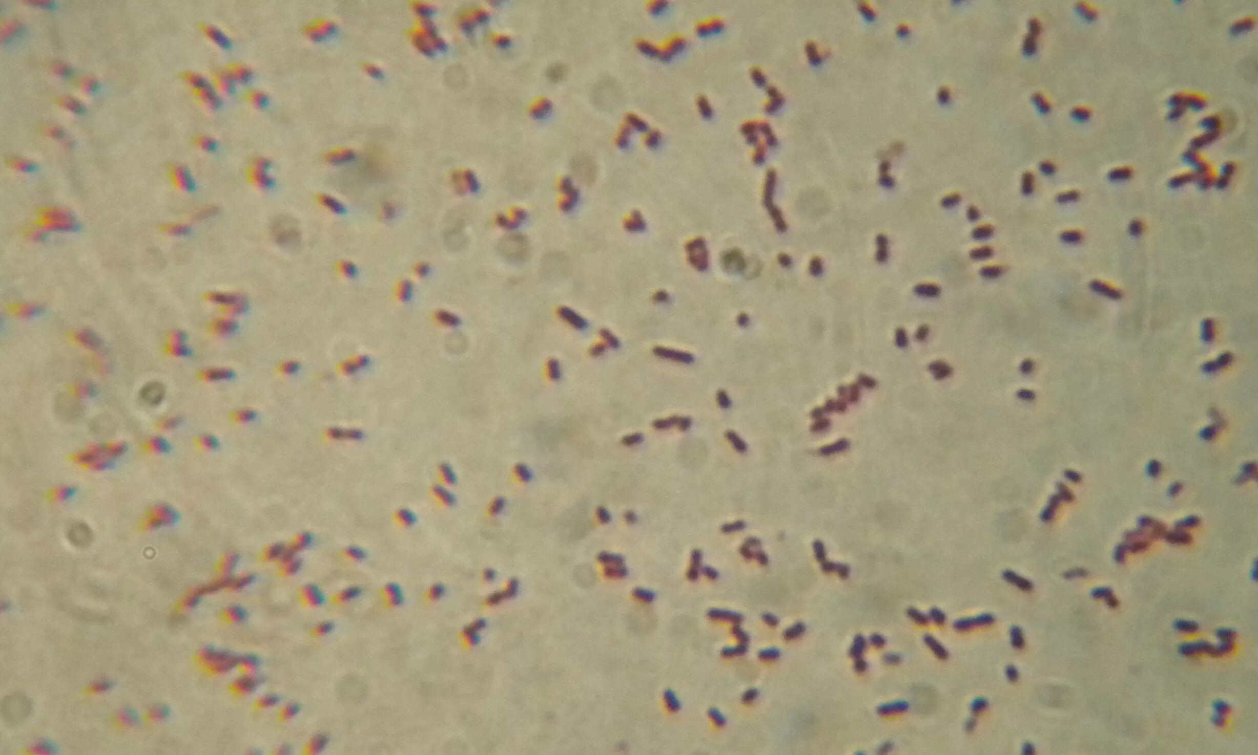 Spp salmonella spp shigella spp