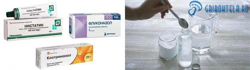 Симптомы молочницы при гв. Лекарство от кандидоза во рту у грудничка. препараты от молочницы у ребенка 2 года. лекарство от молочницы малыша. препарат от молочницы для новорожденных.