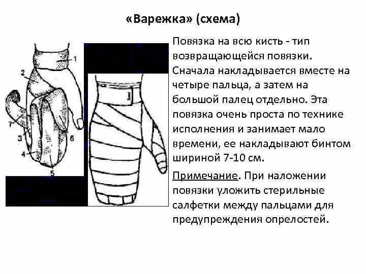 Техника наложения варежки