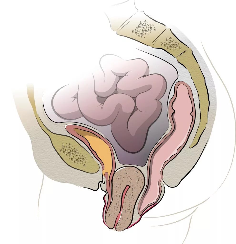 Почему раскрывается матка. Опушение мышц тазрвого дн. Пролапс матки выпадения матки. Пролапс мышц тазового дна.