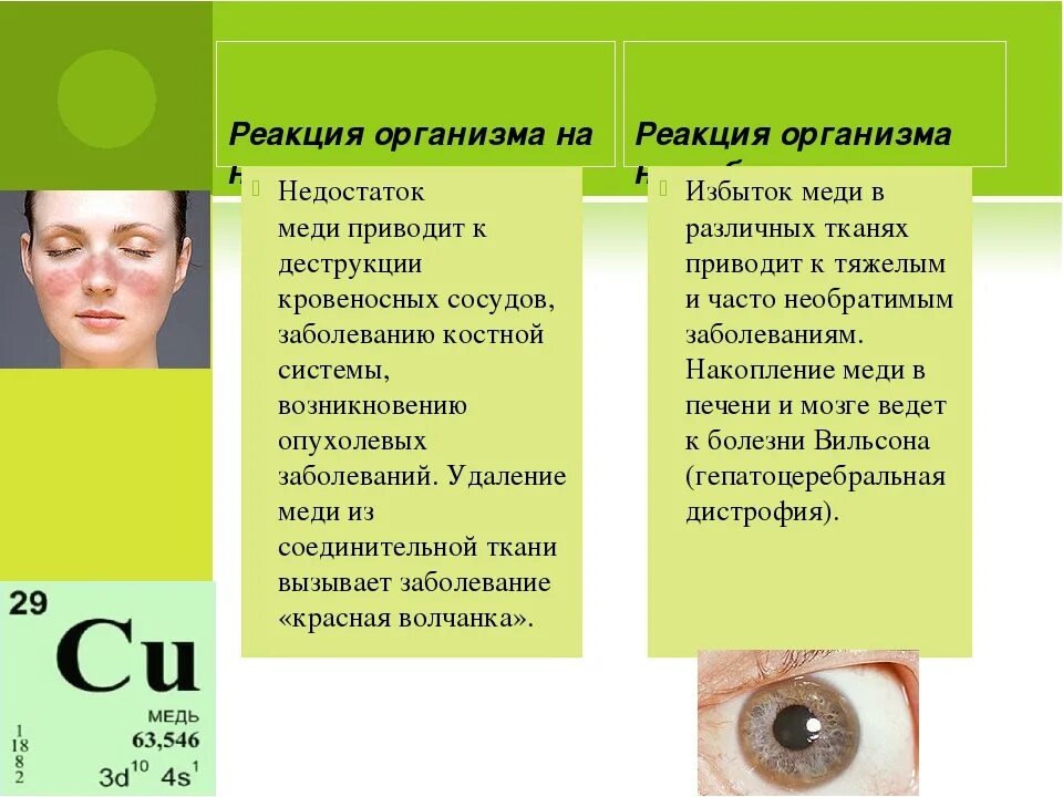 Недостаток фтора может привести к развитию. Недостаток меди симптомы. дефицит меди симптомы. медь избыток и недостаток в организме. недостаток меди заболевания.