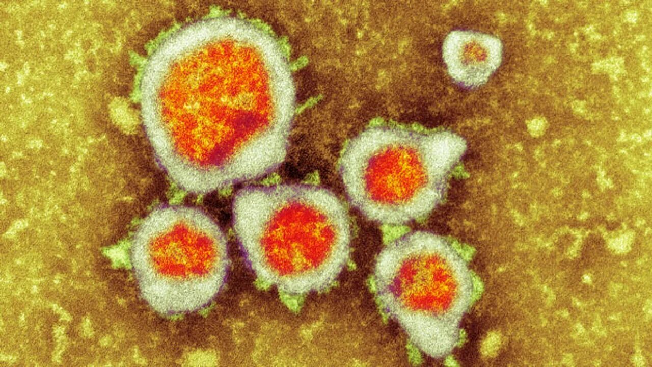 Syncytial virus. Метапневмовирус возбудитель. Вирус HMPV. Синцитиальный вирус микробиология. Бокавирус микробиология.