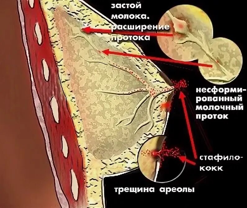 Молоко после достинекса