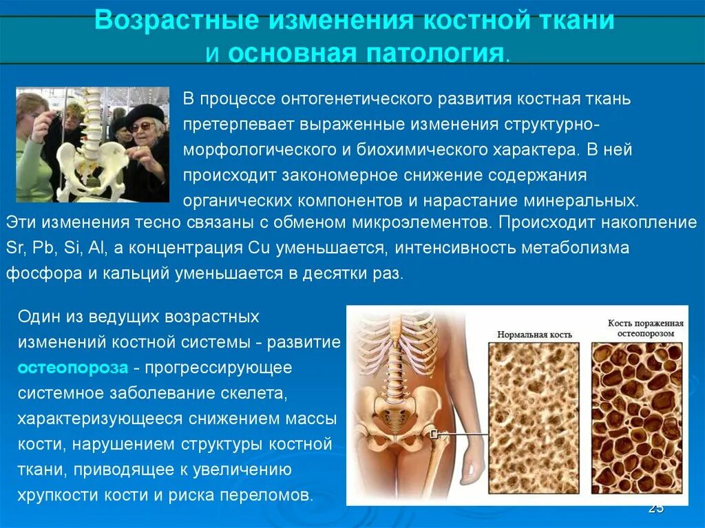 Основным признаком возрастных изменений костей. Возрастные изменения строения кости.. Возрастные изменения костной ткани. Изменение костей с возрастом. Возрастные изменения костей гистология.