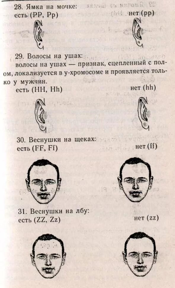 Уши национальность. Еврейские уши. Форма мочек ушей и Национальность. Мочки ушей у евреев. Еврейские уши форма.