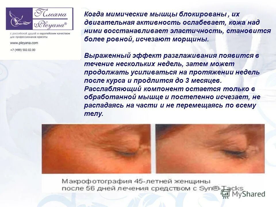 Наиболее выраженным гемостатическим эффектом обладает. Агонистов рецепторов гпп-1. Антилейкотриены механизм. Выраженный эффект. Динамика эффективности.