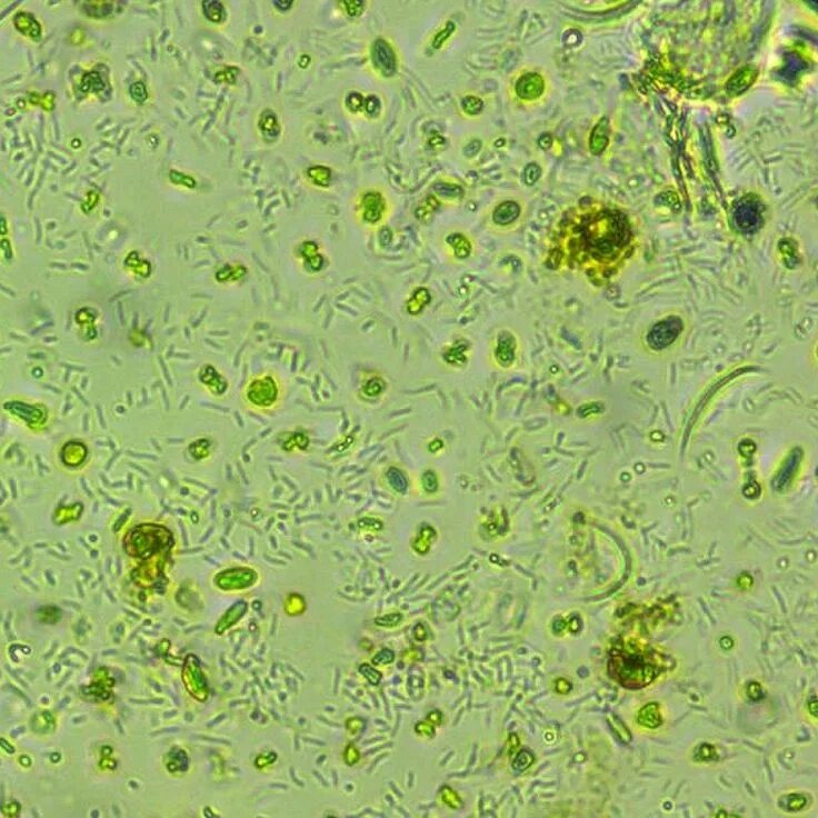 Фитопланктон водоросли. Фитопланктон нанопланктон зоопланктон. Фитопланктон зеленые водоросли. Микроскопические водоросли.
