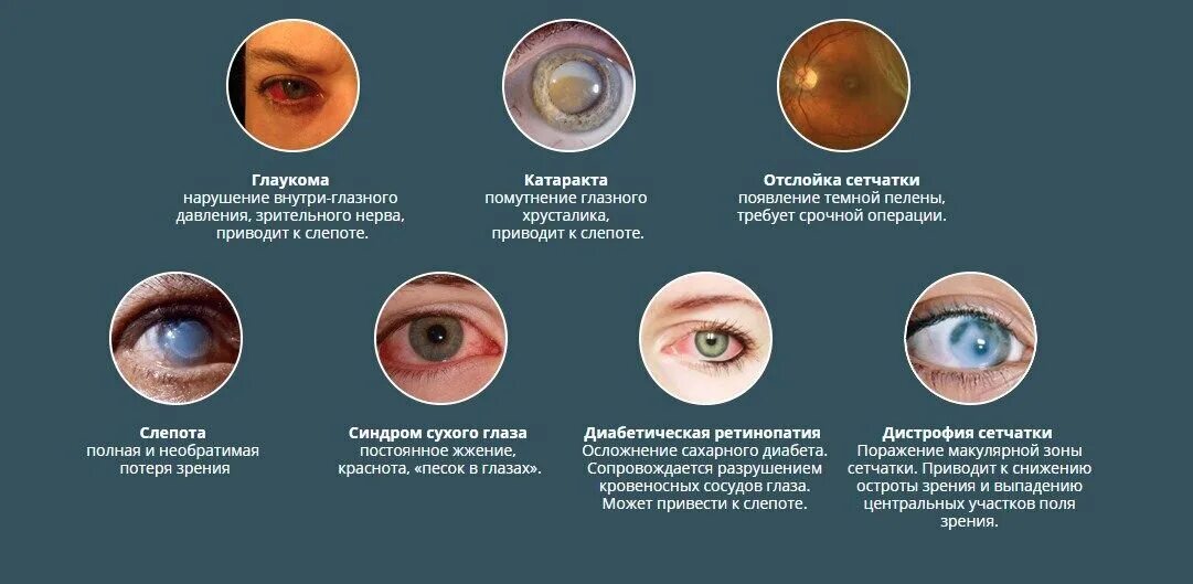 Нарушение зрения. Заболевания глаз со слепотой. Нарушение глаза