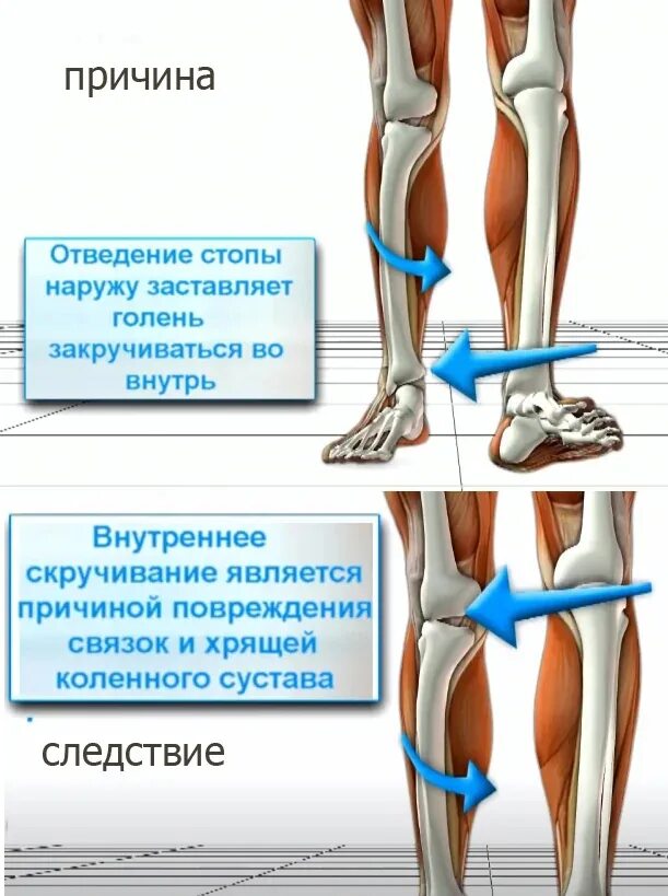 Ноги внутрь при ходьбе