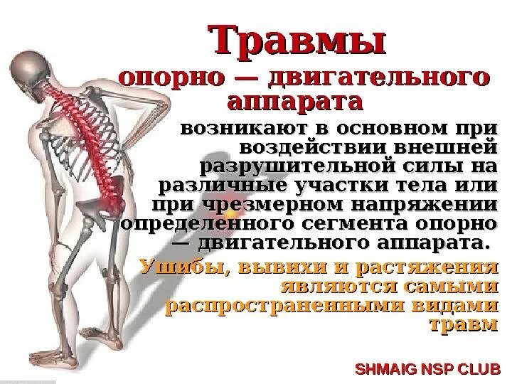 Связанных с опорно двигательным. Основные признаки повреждения опорно-двигательной системы. повреждение позвоночника и опорно двигательного аппарата. травмы опорнодвигаьельной системы. травы опорно-двигательного аппарата.