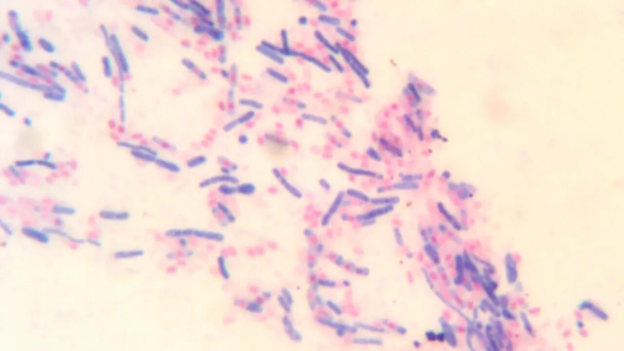 Ожешко микробиология. Метод ожешко микробиология. бациллы ожешко. bacillus окраска ожешко. бактерия bacillus subtilis.