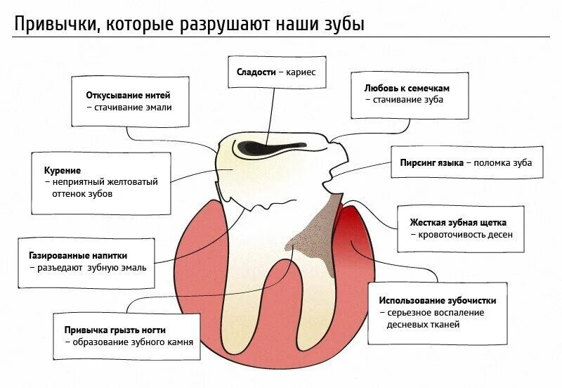 Можно курить после стоматолога. Привычки которые разрушают зубы. Факты о зубах. Интересные факты о зубах. Интересные факт ырпо зубы.