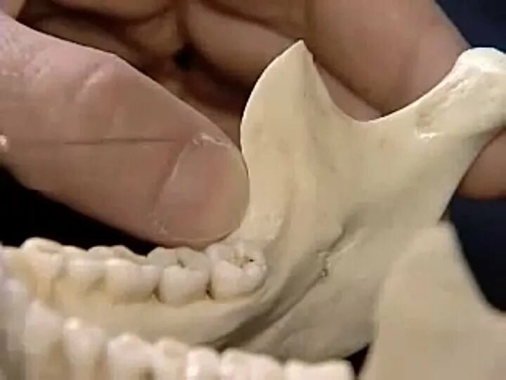 Мандибулярная анестезия нижней челюсти. Мандибулярная анестезия анатомия. Торусальная анестезия нижней челюсти. Мандибулярная анестезия в стоматологии. Гоу гейтс