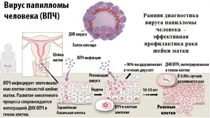 Онкогенный вирус папилломы