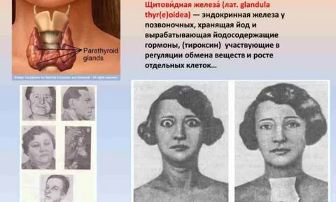 Щитовидная железа почек