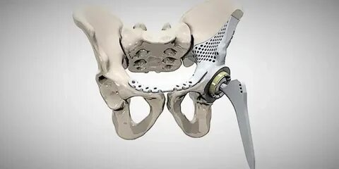3d medical