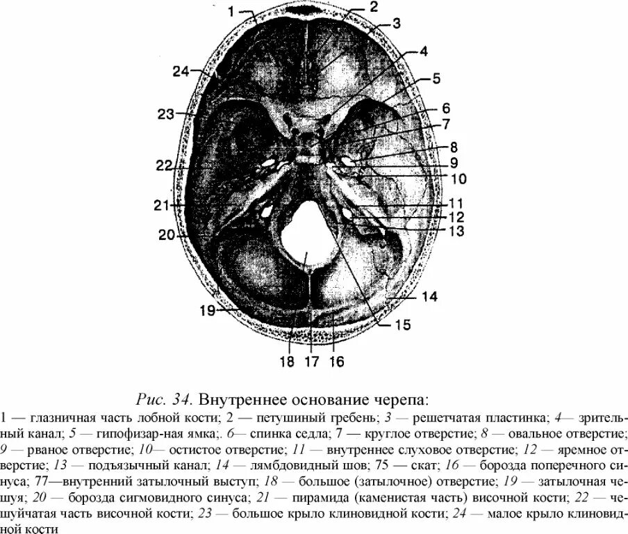 Области основания черепа. Топография внутреннего основания черепа. Внутреннее основание черепа борозды. Кости формирующие основание черепа. Отверстия внутреннего основания черепа.