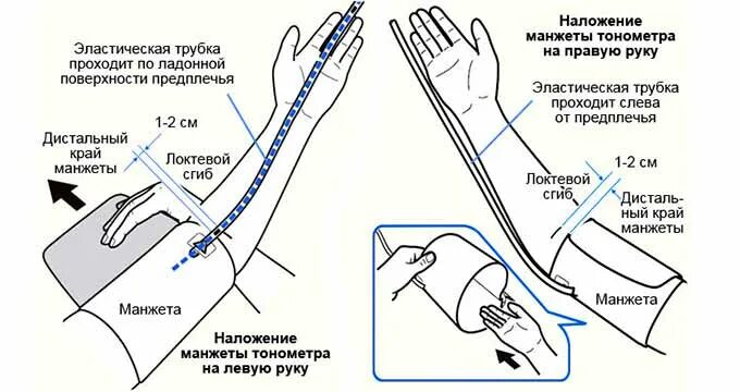 На правой или левой руке мерить давление. Как правильно мерить давление электронным тонометром. Измерение давление на правой или левой руке. При измерении артериального давления манжета накладывается на. Измерение давления на какой руке правильно.