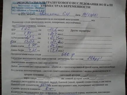 31 неделя беременности нормы