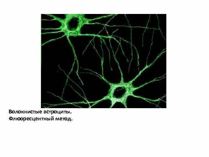 Протоплазматические и волокнистые астроциты. Плазматические астроциты. Волокнистые астроциты. Эпендимоциты, протоплазматические астроциты волокнистые астроциты. Астроцит клиника