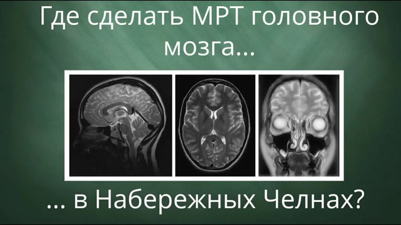 Мрт челны телефон. Мрт мозга. Мрт Набережные Челны. Мрт головного мозга Набережные Челны. Томография головы Набережные Челны.